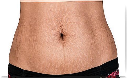 11 foods to reduce stretch marks