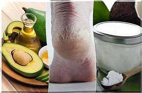 5 homemade creams to moisturize dry heels