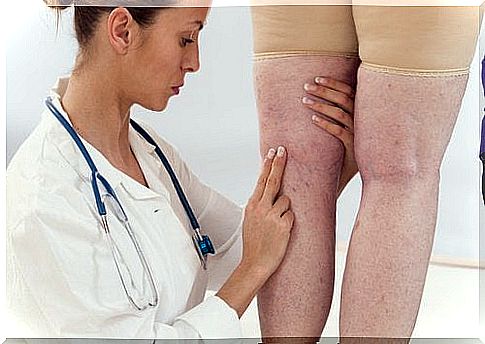 Female doctor checking a patient's legs