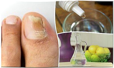 Antifungal for nails to prepare at home