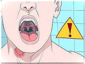 Man with mouth ulcers.