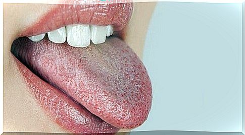 The burning mouth syndrome.