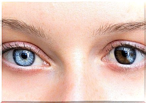 Different colored eyes: is there to worry?