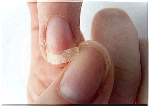 Flaking nails: 9 reasons