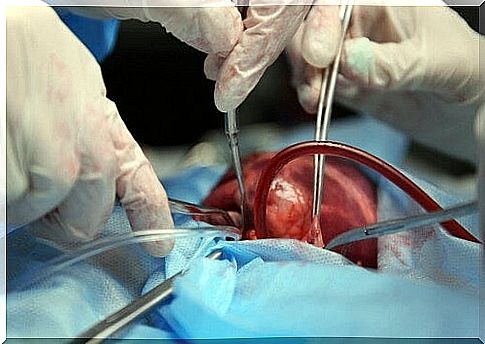 Heart surgery.