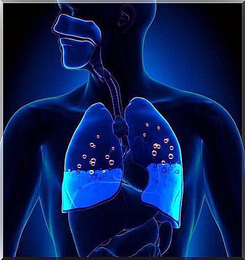 Pulmonary edema: symptoms and causes