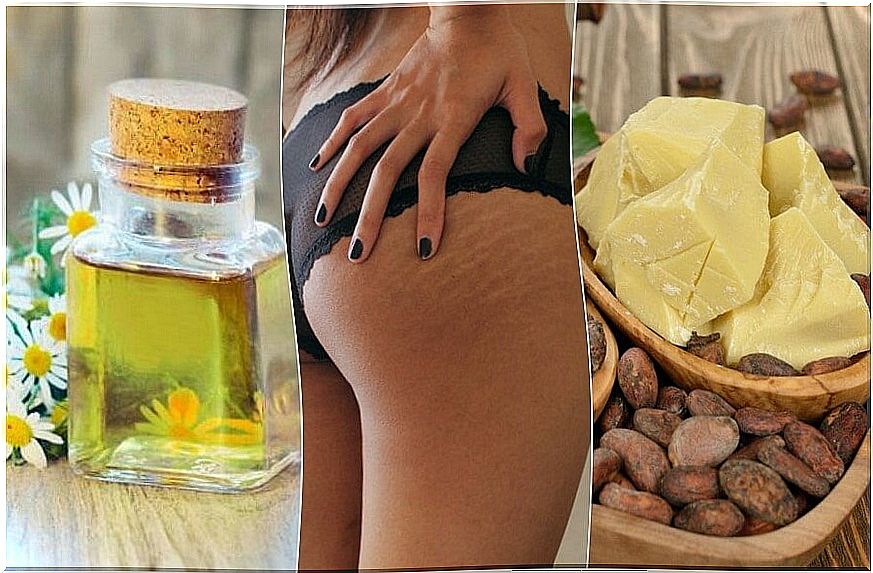 Reduce stretch marks with do-it-yourself remedies