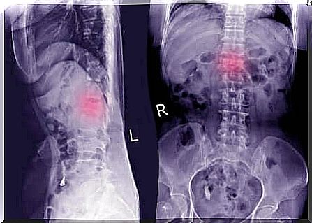 X-ray of the back.