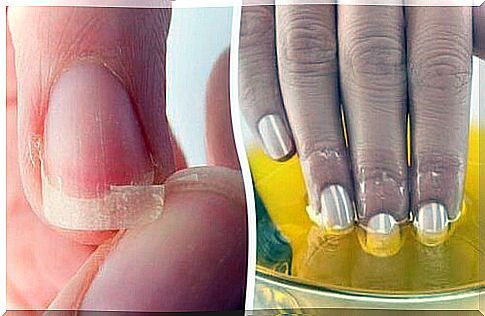 Take care of your nails and strengthen them