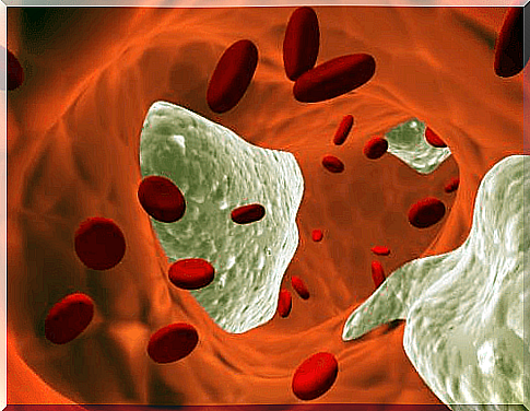 Cholesterol-in-the-blood