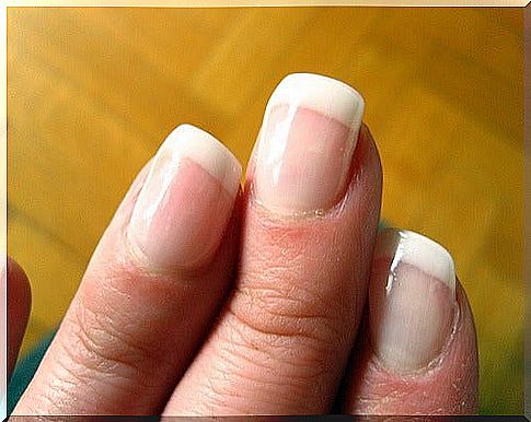 Healthy nails have a pink color and a white tinge at the base