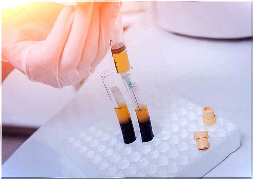 Blood analysis